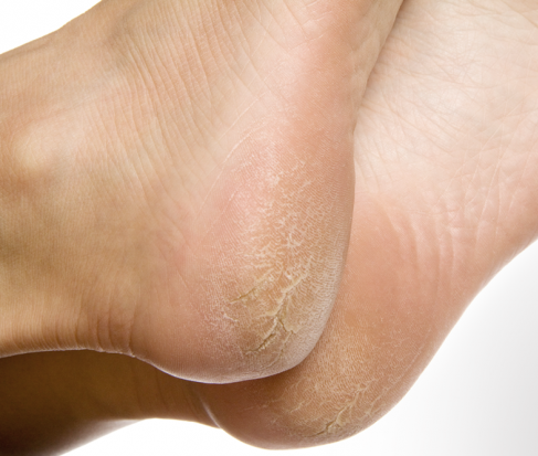 Producto del mes con descuento