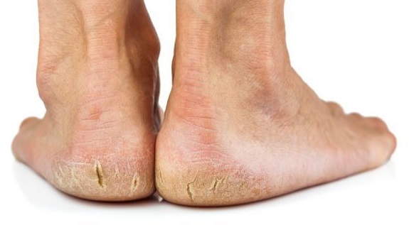 Producto del mes con descuento